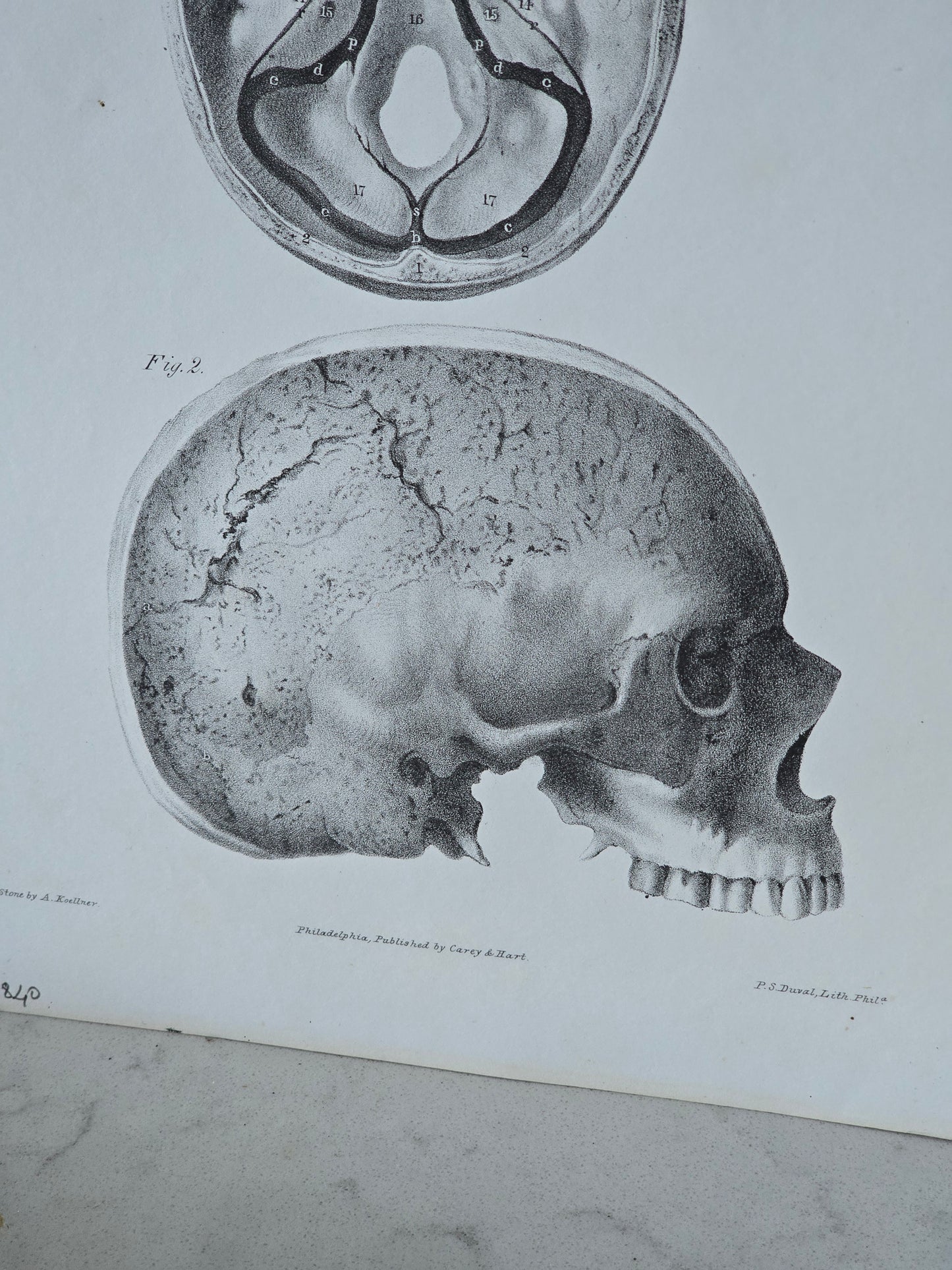 Vanhat v. 1840 anatomiset litografiat