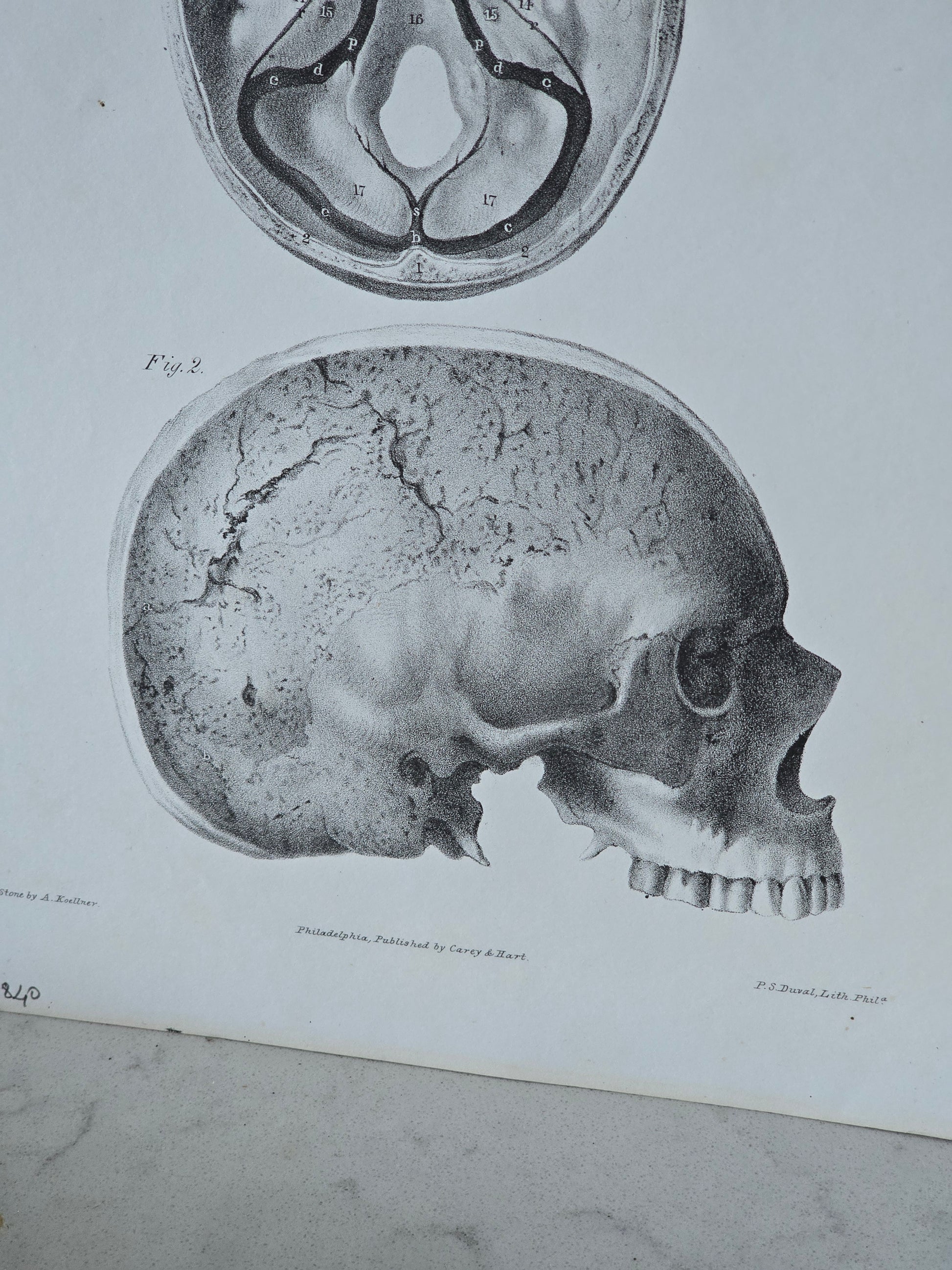 Vanhat v. 1840 anatomiset litografiat