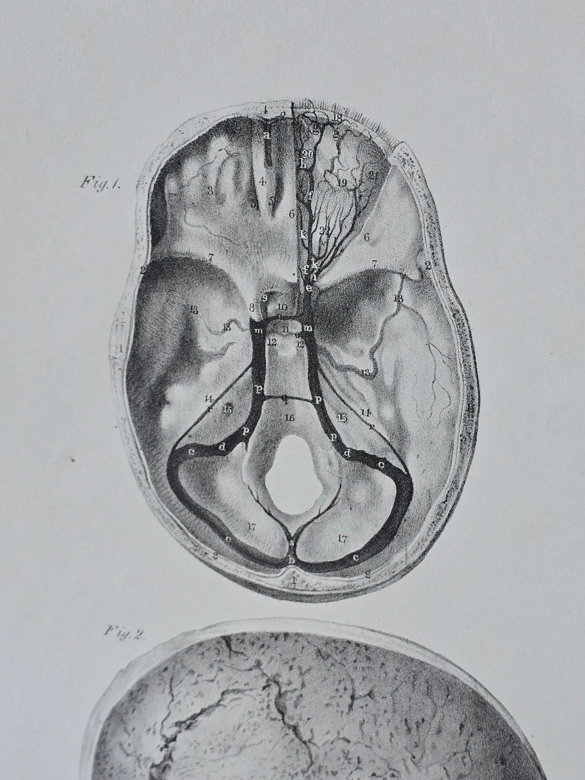 Vanhat v. 1840 anatomiset litografiat