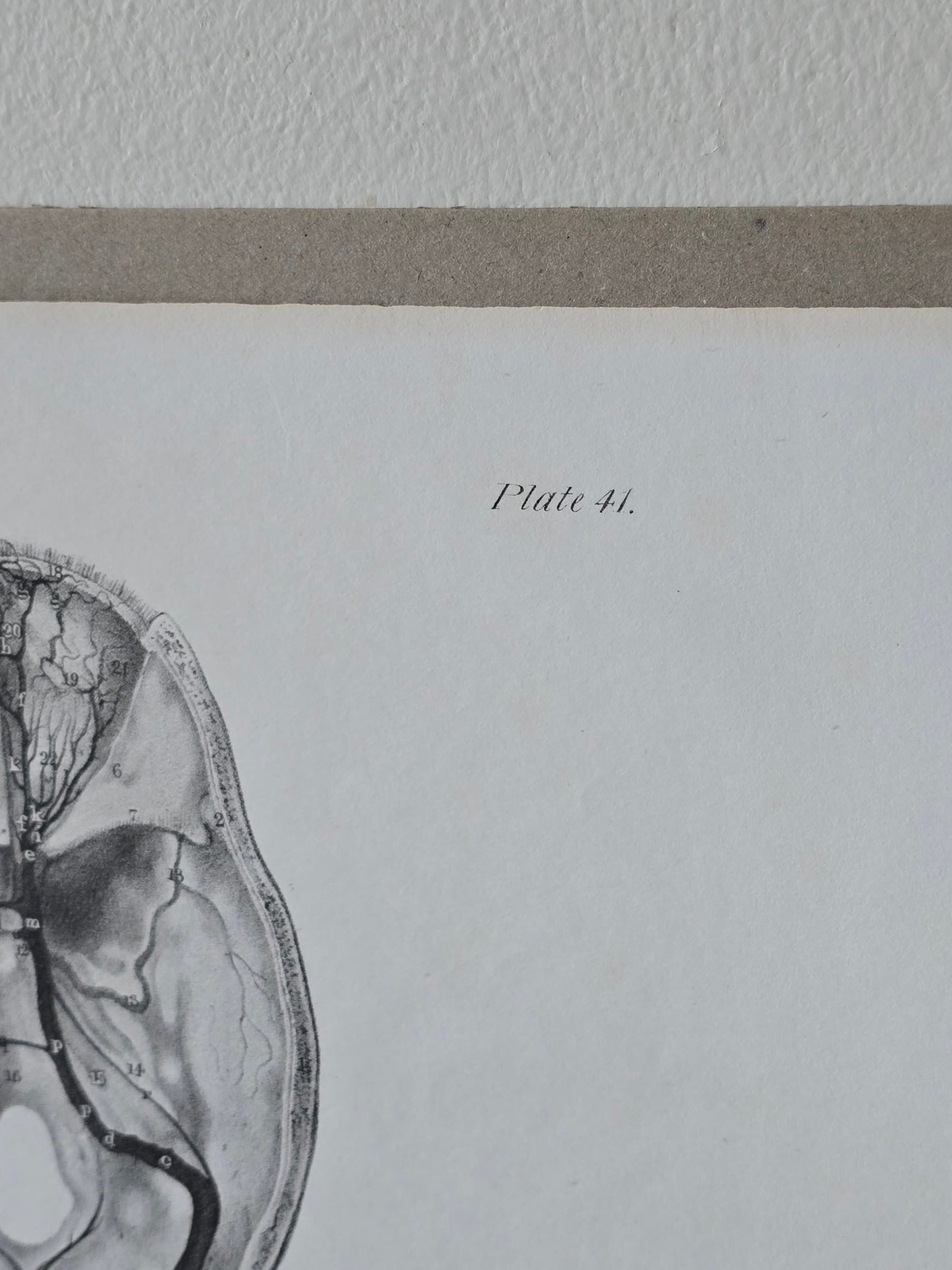 Vanhat v. 1840 anatomiset litografiat