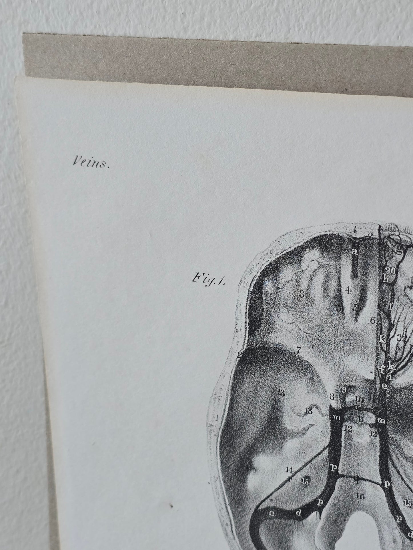 Vanhat v. 1840 anatomiset litografiat