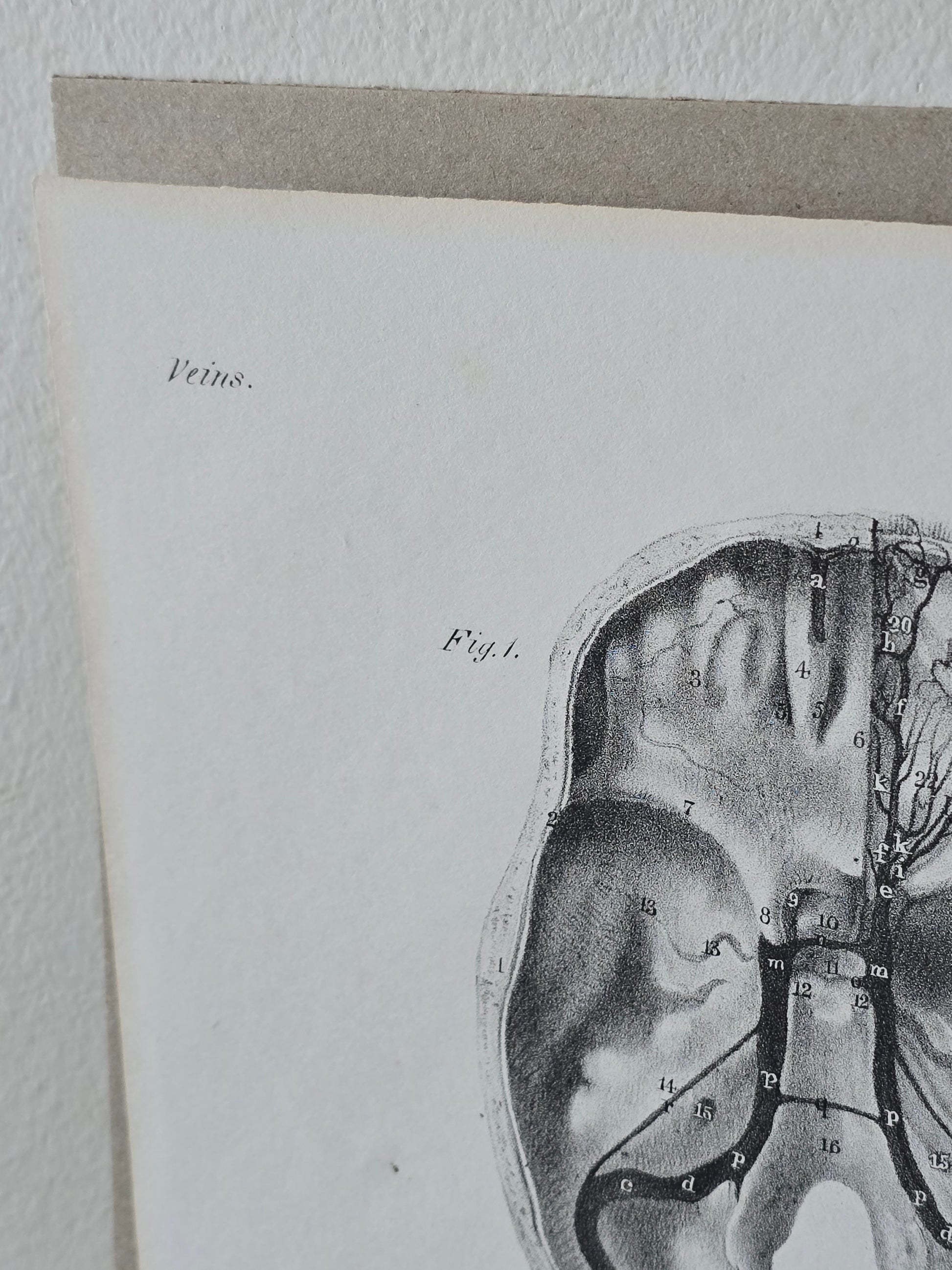 Vanhat v. 1840 anatomiset litografiat